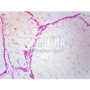 Mammal Adipose Tissue, sec. Microscope Slide, 10 u:  