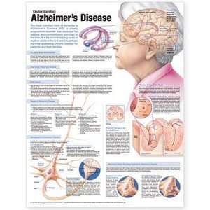   Alzheimerâ?TMs Disease Chart/Poster