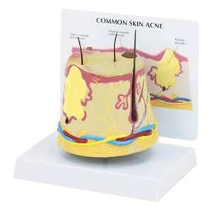 GPI Anatomical Skin Acne Model  Industrial & Scientific