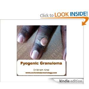 Pyogenic Granuloma (Dermatology) Dr Miriam Kinai  Kindle 