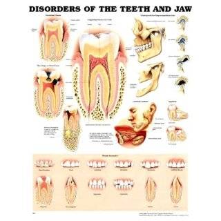  Disorders of the Teeth and Jaw Anatomical Chart Explore 